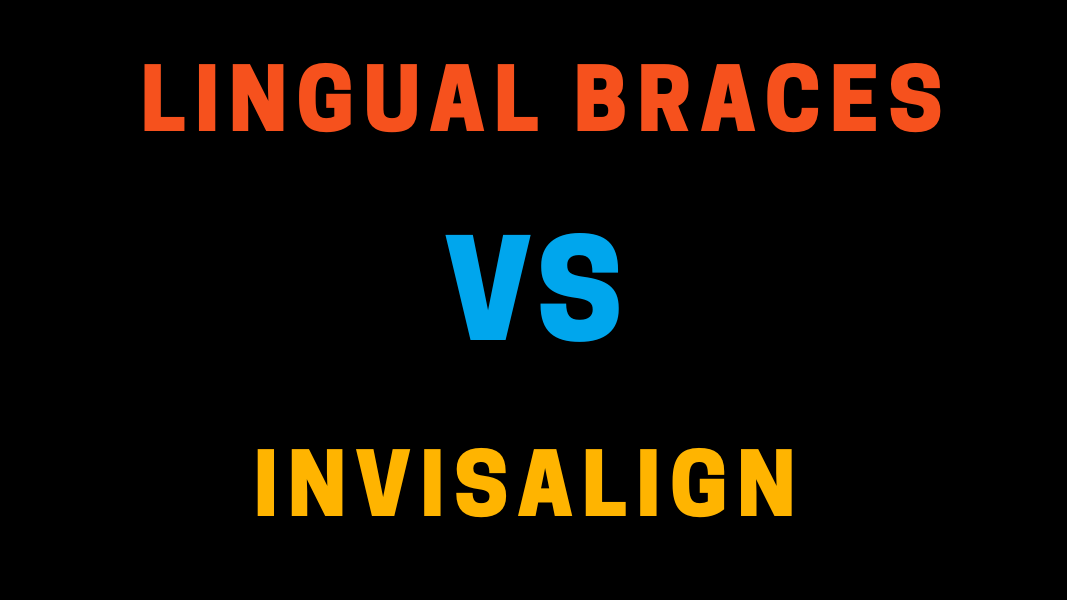 Which is Better Lingual Braces vs Invisalign?