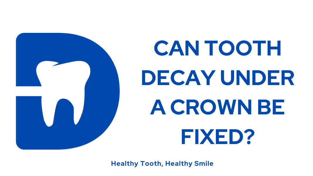 Can Tooth Decay Under a Crown be Fixed?