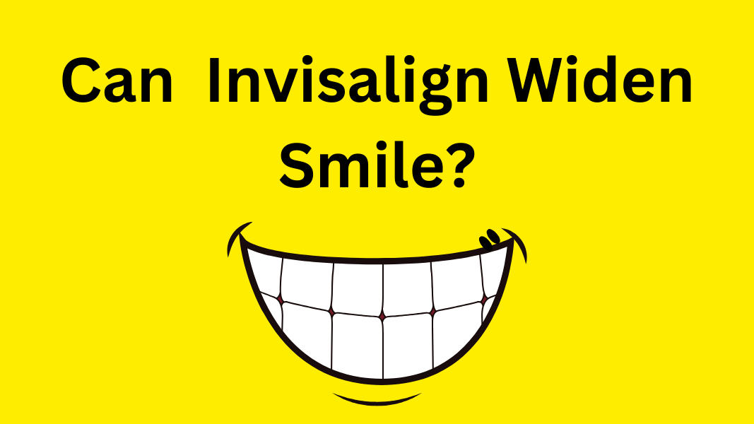 Can Invisalign Widen Smile?