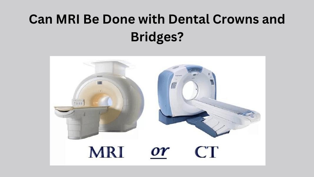 Can MRI Be Done with Dental Crowns and Bridges?