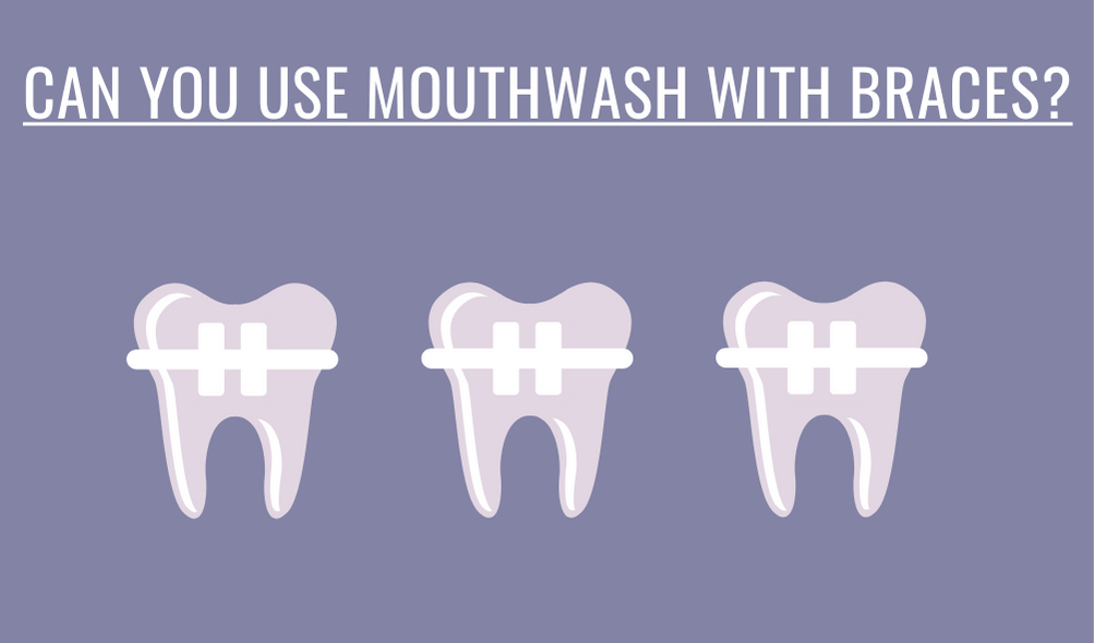 Can You Use Mouthwash With Braces?