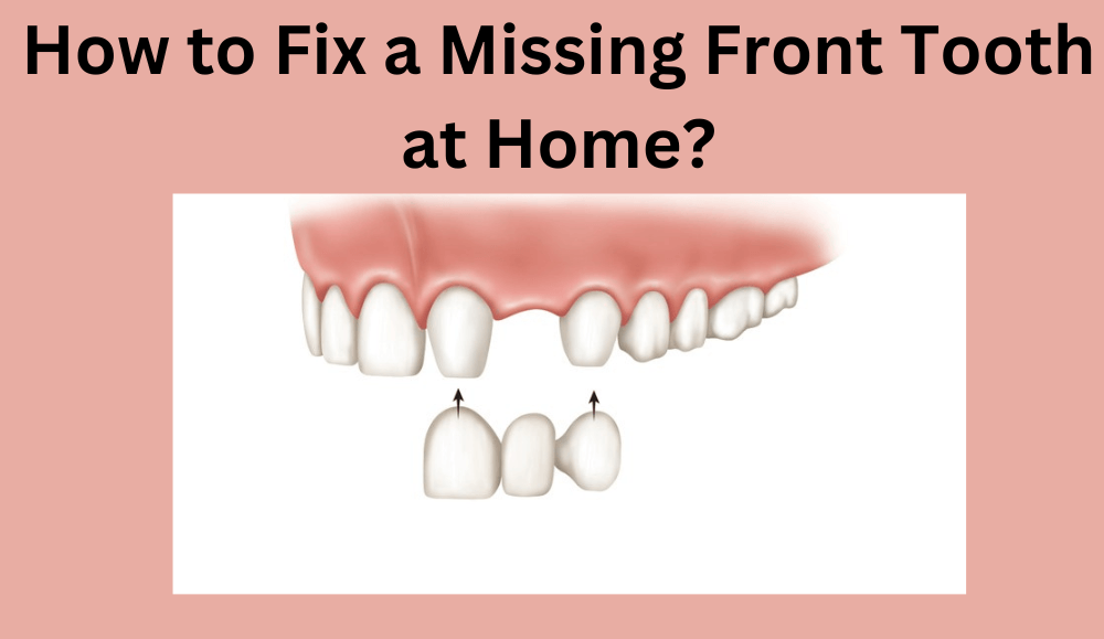 How to Fix a Missing Front Tooth at Home?