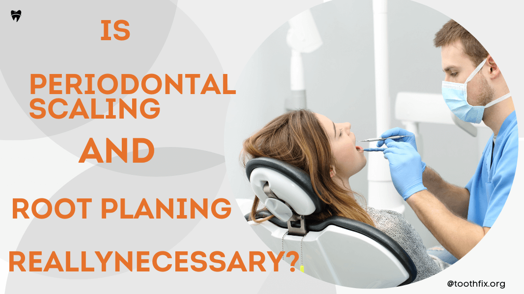 Is Periodontal Scaling and Root Planning Really Necessary?